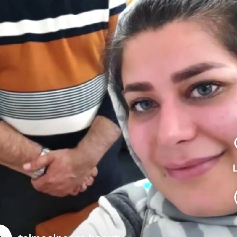 تجميل مع نورا في ايران